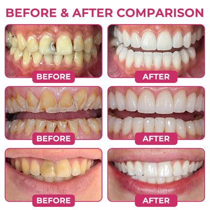 💥100K+ SOLD💕 - COUGEX® Cavity-Repair Natural Enamel Filling Gel